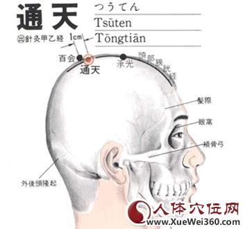 通天穴|通天穴